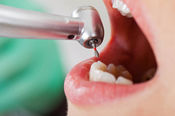 Best Tooth Pain Emergency Relief  in Madison, MN